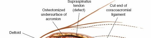Illustration 97 for Essential Guide: Mastering Every Approach to the Shoulder