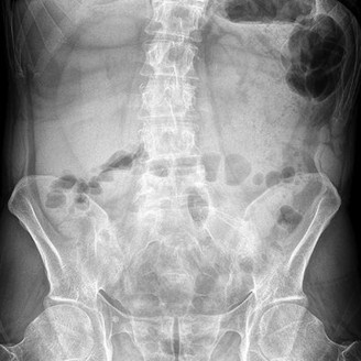 Orthopedic Board Review MCQs (2026 Edition) - Part 3