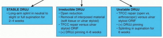 Illustration 10 for Galeazzi DRUJ Stabilization: Unlocking Stability with Smooth Stainless Steel