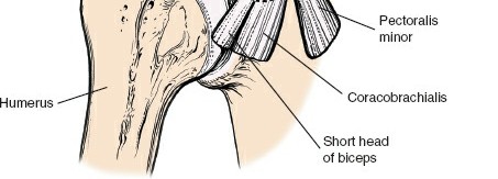 Illustration 7 for Enhance Anterior Shoulder Surgery: Crucial Joint Applied Surgical Anatomy