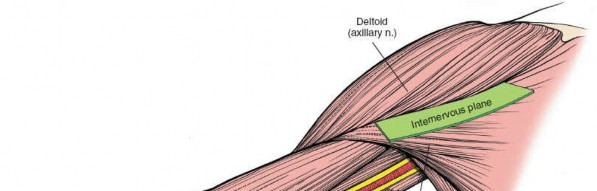 Illustration 5 for Mastering the Approach to the Distal Humerus: Safety & Skills