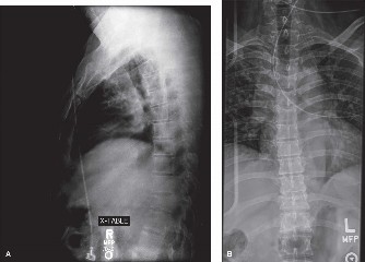 Illustration 58 for Master Orthopedic Spine Cases: Sharpen Your Diagnostic Skills