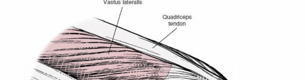 Illustration 161 for Mastering Knee Approaches: Spotlight on Superficial Medial Ligament