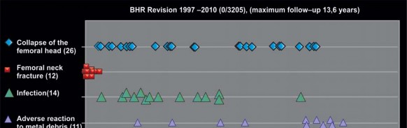 Illustration 108 for Birmingham Hip Resurfacing Designer's Technique for Active Lives