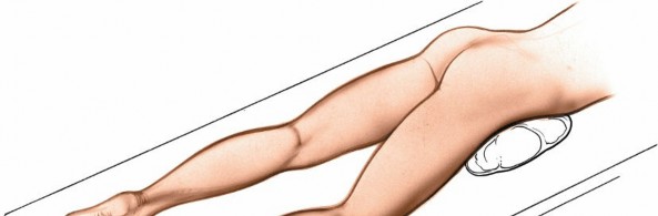 Illustration 81 for Optimized Approaches to the Dorsum of the Foot & Ankle