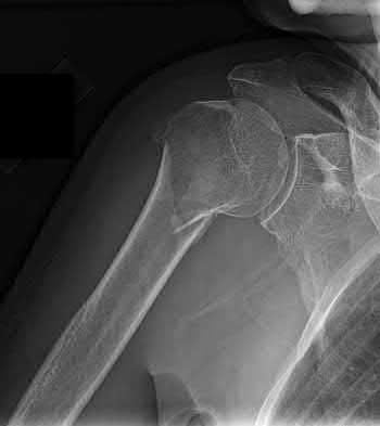 Illustration 196 for OrthoCash: Trauma MCQs & Cases for a yearold woman