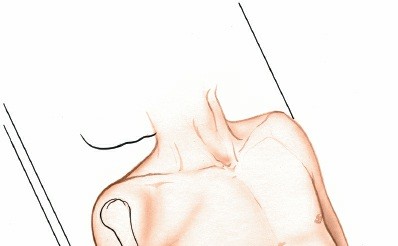 Illustration of brevis and the extensor - Dr. Mohammed Hutaif
