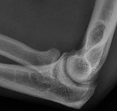 Illustration 36 for OrthoCash: Trauma MCQs & Cases for a yearold woman