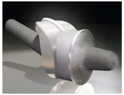 وداعاً لألم إبهام القدم: دليل شامل لاستبدال مفصل المشط السلامي الأول بتقنية Roto-Glide المتقدمة