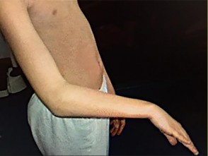 صورة توضيحية لـ دليل الأستاذ الدكتور محمد هطيف الشامل لأمراض وإصابات اليد والمعصم في صنعاء