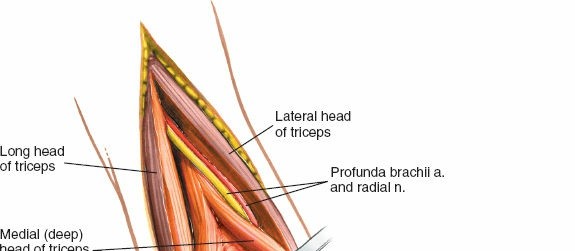 Illustration 44 for Mastering the Approach to the Distal Humerus: Safety & Skills