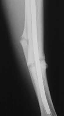 Illustration 141 for OrthoCash: Trauma MCQs & Cases for a yearold woman