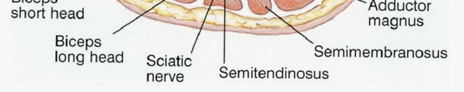 Illustration 4 for Advanced Distal Femoral Resections: Limb-Sparing Outcomes & Techniques