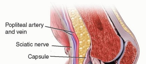 Illustration of femur and tibia - Dr. Mohammed Hutaif