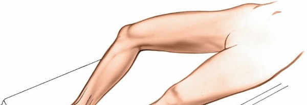 Illustration 44 for Optimized Approaches to the Dorsum of the Foot & Ankle