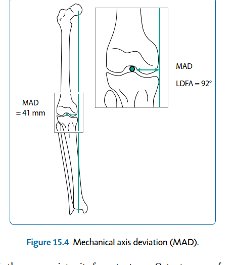 Illustration 4 for Limb Reconstruction: Restoring Function for Challenges Near and Far