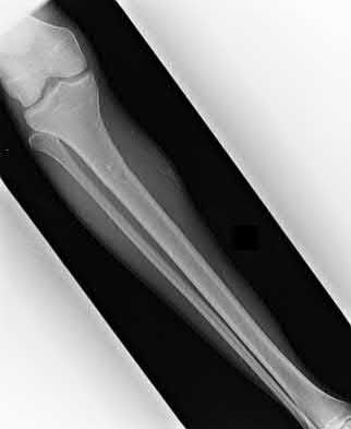 Illustration 205 for OrthoCash: Trauma MCQs & Cases for a yearold woman