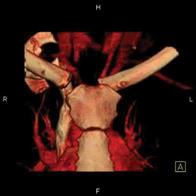 Illustration 46 for OrthoCash: Trauma MCQs & Cases for a yearold woman