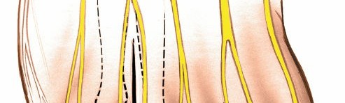 Illustration 222 for Optimized Approaches to the Dorsum of the Foot & Ankle