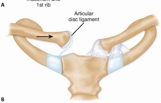 Illustration 3 for Optimizing SC Dislocation Repair After Medial Clavicle Resection