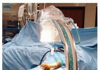 Bridge Plating: The Key to Challenging Plating of Distal Fractures