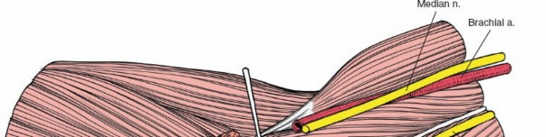 Illustration 109 for Mastering Elbow Approaches: Applied Surgical Anatomy for Precision