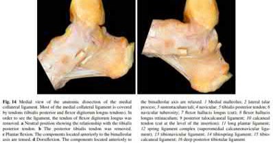 Illustration 102 for OrthoCash: Trauma MCQs & Cases for a yearold woman