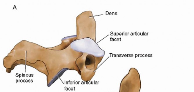 Illustration 13 for Master Techniques for Cervical Fracture Reduction: Type III & More
