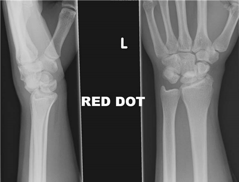 Illustration 8 for Master Hands and Paediatric Orthopaedics: Diagnose & Treat