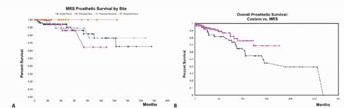 Illustration 31 for Distal Femoral Replacement: Key to Modern Limb Salvage