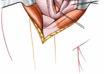 Illustration 38 for Essential Guide: Mastering Every Approach to the Shoulder
