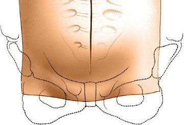 Illustration 81 for Approach to the Lumbar Spine: Mastering Techniques & Anatomy