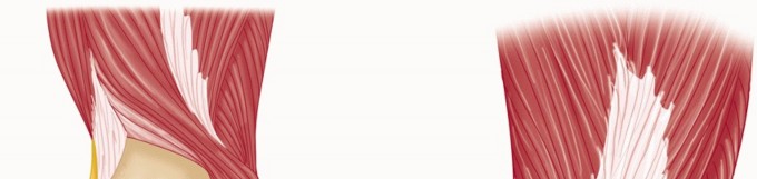 Illustration 36 for Surgical Approaches to Shoulder & Elbow: Pearls and Pitfalls