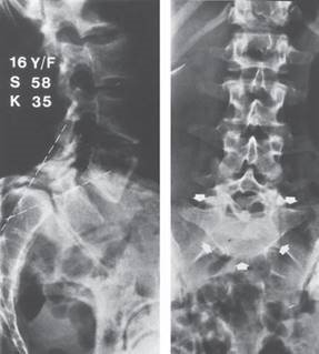 Illustration 19 for Ace FRCS Orthopaedics: Oxford University Press Adult Pathology Viva