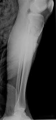 Illustration 171 for OrthoCash: Trauma MCQs & Cases for a yearold woman