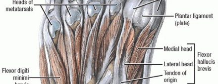 Illustration 2 for Restore Your Foot: Surgical Treatment for Hallux MP Joint Turf Toe