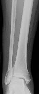 Illustration 142 for OrthoCash: Trauma MCQs & Cases for a yearold woman