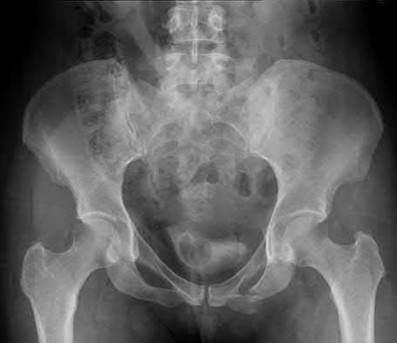 Illustration 191 for OrthoCash: Trauma MCQs & Cases for a yearold woman