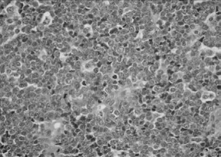 ساركوما إيوينج: دليل شامل للمرضى من التشخيص إلى التعافي مع الأستاذ الدكتور محمد هطيف