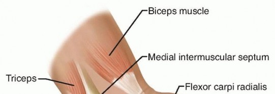 Surgical Treatment of Cubital Tunnel Syndrome