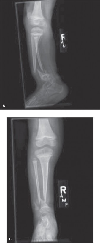 Illustration 2 for Bowed Leg & Spots: A Pediatric Orthopedic Case Challenge