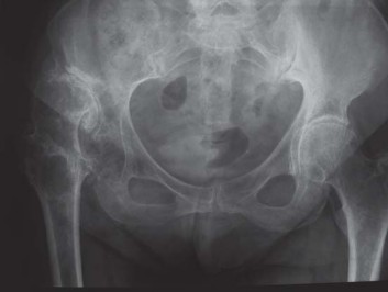 Illustration 37 for S-ROM: Inside the Technique of Modular Implant Design