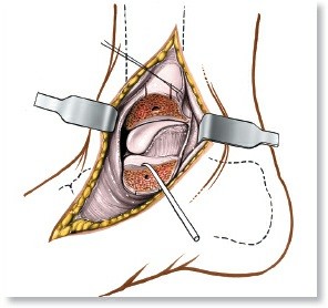 Illustration of dorsum of the foot - Dr. Mohammed Hutaif
