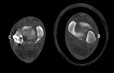 Illustration 54 for OrthoCash: Trauma MCQs & Cases for a yearold woman