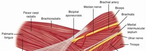 صورة توضيحية لـ تيبس وتقلصات مفصل الكوع: الدليل الشامل للعلاج واستعادة الحركة مع الأستاذ الدكتور محمد هطيف