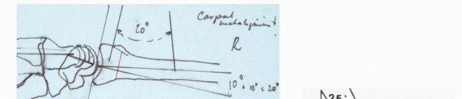 Illustration 6 for Precision Correction for Distal Radius Malunion