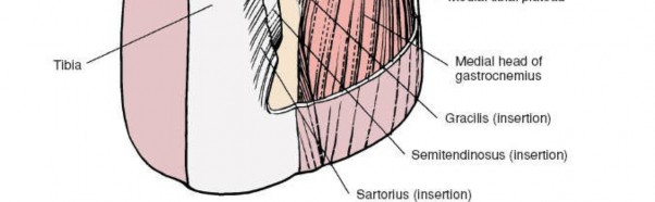 Illustration 101 for Mastering Knee Approaches: Spotlight on Superficial Medial Ligament