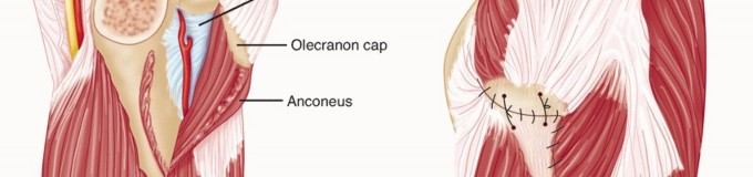 Illustration 38 for Surgical Approaches to Shoulder & Elbow: Pearls and Pitfalls