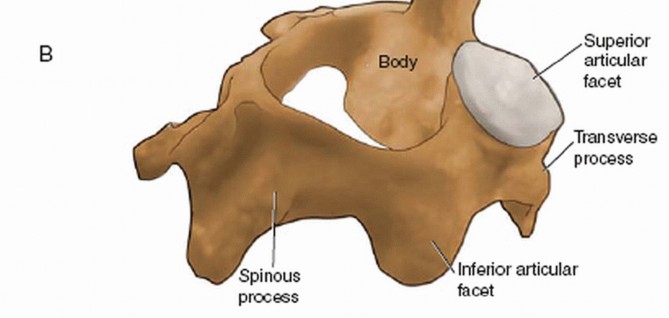 Illustration 14 for Master Techniques for Cervical Fracture Reduction: Type III & More