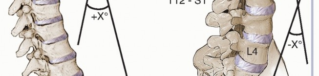 Illustration 16 for Adult Scoliosis: Uncover Causes & Find Lasting Back Pain Relief